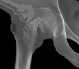 Illustration of hip x-ray